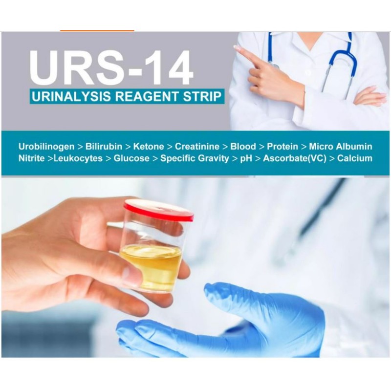 Test za analizo urina URS-14 parametrov (100 lističev)